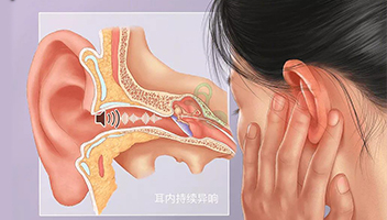 耳鸣专科
