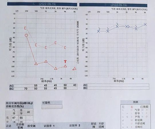听损评定